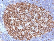 IHC testing of FFPE human tonsil with MCM7 antibody (clone MCM7/1466). Required HIER: boil tissue sections in pH 9 10mM Tris with 1mM EDTA for 10-20 min.
