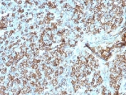 IHC testing of FFPE human tonsil tissue with HLA-DP/DQ/DR antibody (clone CR3/43). Required HIER: boil tissue sections in 10mM citrate buffer, pH 6, for 10-20 min.