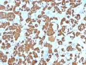 IHC testing of FFPE human pituitary gland with Growth Hormone antibody (clone SPM106). Required HIER: boil tissue sections in pH 9 10mM Tris with 1mM EDTA for 10-20 min.