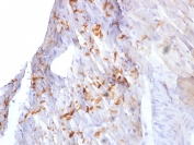 IHC testing of FFPE mouse heart tissue with CDH2 antibody. Required HIER: boil tissue sections in 10mM Tis with pH 9 1mM EDTA for 10-20 min followed by cooling at RT for 20 min.