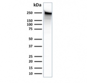 Western blot testing of human PANC-1 cell lysate with Spectrin beta III antibody. Predicted molecular weight ~246 kDa.