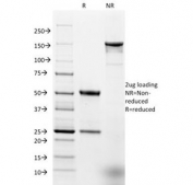 SDS-PAGE analysis of purified, BSA-free Ep-CAM antibody (clone EGP40/1798) as confirmation of integrity and purity.