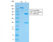 SDS-PAGE analysis of purified, BSA-free recombinant CD43 antibody (clone SPN/1766R) as confirmation of integrity and purity.