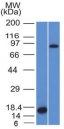 Western blot testing of 1) partial human recombinant protein and 2) human HeLa lysate with Factor XIIIa antibody (clone F13A1/1448). Expected molecular weight ~83 kDa.