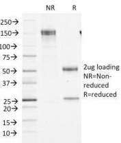 SDS-PAGE Analysis of Purified, BSA-Free Factor XIIIa Antibody (clone F13A1/1448). Confirmation of Integrity and Purity of the Antibody.
