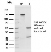 SDS-PAGE analysis of purified, BSA-free PHB antibody (clone PHB/1882) as confirmation of integrity and purity.