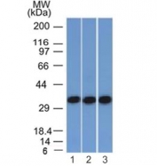 Western blot testing of human 1) HEK293, 2) A431 and 3) HCT116 cell lysate with anti-EpCAM antibody (clone EGP40/1372). Expected molecular weight: ~35 kDa (unmodified), 40-43 kDa (glycosylated).