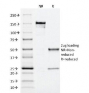SDS-PAGE Analysis of Purified, BSA-Free MRP1 Antibody (clone MRP1/1344). Confirmation of Integrity and Purity of the Antibody.