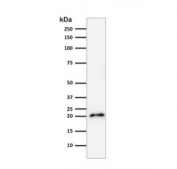 Western blot testing of human HeLa cell lysate with recombinant CDNK1A antibody (clone CIP1/2275R).