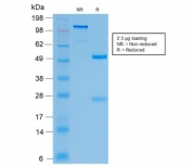 SDS-PAGE analysis of purified, BSA-free recombinant CFTR antibody (clone CFTR/2290R) as confirmation of integrity and purity.