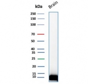 Western blot testing of human brain tissue lysate with recombinant S100B antibody (clone rS100B/1896). Predicted molecular weight ~11 kDa.