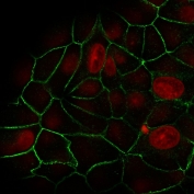 Immunofluorescent staining of human MCF7 cells with recombinant E-Cadherin antibody (green, clone rCDH1/1525) and Reddot nuclear stain (red).