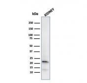 Western blot testing of human kidney lysate with Ferritin Light Chain antibody. Predicted molecular weight: ~20 kDa.