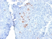 IHC testing of FFPE human tonsil with recombinant human IgG antibody (clone rIG266). Required HIER: boil tissue sections in 10mM citrate buffer, pH 6, for 10-20 min followed by cooling at RT for 20 min.