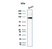 Western blot testing of human brain tissue lysate with recombinant beta Catenin antibody. Predicted molecular weight ~85 kDa, but routinely observed at 90-95 kDa.