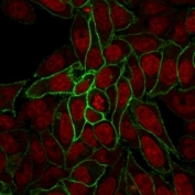 Immunofluorescent staining of human HeLa cells with recombinant beta Catenin antibody (clone rCTNNB1/2173, green) and Reddot nuclear stain (red).