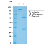 SDS-PAGE analysis of purified, BSA-free recombinant Filaggrin antibody (clone rFLG/1561) as confirmation of integrity and purity.