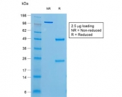 SDS-PAGE analysis of purified, BSA-free recombinant TG antibody (clone r6E1) as confirmation of integrity and purity.