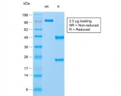 SDS-PAGE analysis of purified, BSA-free recombinant Napsin A antibody (clone rNAPSA/1239) as confirmation of integrity and purity.