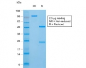 SDS-PAGE analysis of purified, BSA-free recombinant TG antibody (clone TGB/1970R) as confirmation of integrity and purity.