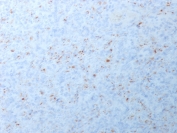 IHC testing of FFPE human spleen with recombinant MMP3 antibody (clone MMP3/1994R). Required HIER: boil tissue sections in pH6, 10mM citrate buffer, for 10-20 min followed by cooling at RT for 20 min.