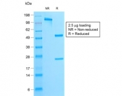 SDS-PAGE analysis of purified, BSA-free recombinant Parathyroid Hormone antibody (clone rPTH/911) as confirmation of integrity and purity.