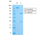 SDS-PAGE analysis of purified, BSA-free recombinant HSV1 antibody (clone HSV1/1934) as confirmation of integrity and purity.