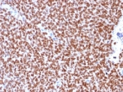 IHC testing of Ewing