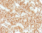 IHC testing of FFPE human parathyroid gland stained with recombinant Parathyroid Hormone antibody (clone PRTM1-1R). Required HIER: steam sections in pH 9 10mM Tris with 1mM EDTA for 10-20 min.
