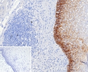 IHC testing of FFPE human esophagus tissue with CD44v6 antibody (clone CD44V6/2496). Required HIER: steam sections in pH 9 10mM Tris with 1mM EDTA buffer for 10-20 min and allow to cool before testing.
