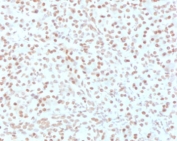 IHC testing of FFPE human pancreas with AKT1 antibody (clone RASTPK-1). HIER: boil tissue sections in pH 9 10mM Tris with 1mM EDTA for 10-20 min followed by cooling at RT for 20 min. 