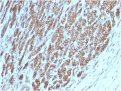 IHC testing of FFPE human tonsil tissue with Beta Catenin antibody (clone CTNNB1/2098). HIER: boil tissue sections in pH 9 10mM Tris with 1mM EDTA for 20 min and allow to cool before testing.