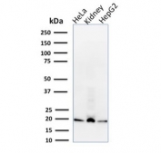 Western blot testing of human HeLa, kidney and HepG2 cell lysate with ARF1 antibody (clone 1A9/5). Predicted molecular weight ~21 kDa.