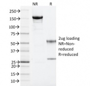 SDS-PAGE analysis of purified, BSA-free ARF1 antibody (clone 1A9/5) as confirmation of integrity and purity.