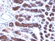 IHC testing of FFPE rat stomach with Mesothelin antibody (clone MSLN/2131). HIER: boil tissue sections in pH 9 10mM Tris with 1mM EDTA for 10-20 min followed by cooling at RT for 20 min.