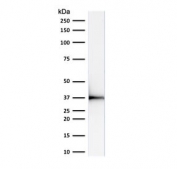 Western blot testing of human HeLa cell lysate with Emerin antibody (clone EMD/2168). Expected molecular weight: 29-34 kDa.