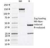 SDS-PAGE analysis of purified, BSA-free Estrogen Receptor alpha antibody (clone ESR1/1935) as confirmation of integrity and purity.