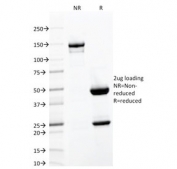 SDS-PAGE analysis of purified, BSA-free CD103 antibody (clone ITGAE/2063) as confirmation of integrity and purity.