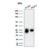 Western blot testing of human A431 and MCF7 cell lysate with TROP2 antibody (clone TACSTD2/2151). Predicted molecular weight ~36 kDa.