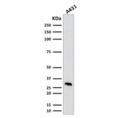 Western blot testing of human A431 cell lysate with MTAP antibody (clone MTAP/1813). Expected molecular weight: 26-38 kDa (multiple isoforms).