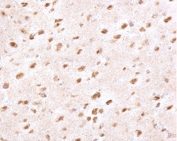 IHC staining of FFPE human brain with Ubiquitin antibody (clone PBQN-1). Required HIER: boil tissue sections in pH 9 10mM Tris with 1mM EDTA for 10-20 min followed by cooling at RT for 20 min.