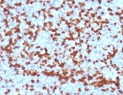 IHC testing of FFPE human tonsil with ZAP70 antibody (clone ZPT70-2). HIER: boil tissue sections in pH 9 10mM Tris with 1mM EDTA for 10-20 min followed by cooling at RT for 20 min.