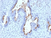 IHC testing of FFPE human endometrium with Podocalyxin antibody (clone PODXL/2185). HIER: boil tissue sections in pH6, 10mM citrate buffer, for 10-20 min followed by cooling at RT for 20 min.
