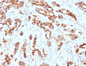IHC testing of FFPE human prostate tissue with AURKB antibody (clone ARRK2-1). HIER: boil tissue sections in pH6, 10mM citrate buffer, for 10-20 min followed by cooling at RT for 20 min.