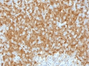 IHC testing of FFPE human lymph node with TCL1 antibody (clone TLLP1-1). HIER: boil tissue sections in pH 9 10mM Tris with 1mM EDTA for 10-20 min followed by cooling at RT for 20 min.