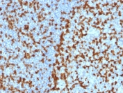IHC testing of FFPE human tonsil with ZAP70 antibody (clone ZAP70/2047). HIER: boil tissue sections in pH 9 10mM Tris with 1mM EDTA for 10-20 min followed by cooling at RT for 20 min.