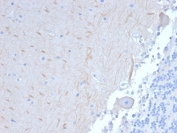 IHC staining of FFPE human brain with ATG5 antibody (clone ATG5/2101). Required HIER: boil tissue sections in 10mM citrate buffer, pH 6, for 10-20 min followed by cooling at RT for 20 min.