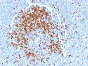 IHC testing of FFPE human tonsil tissue with ZAP70 antibody (clone TCL1/2078). HIER: boil tissue sections in pH 9 10mM Tris with 1mM EDTA for 10-20 min followed by cooling at RT for 20 min.