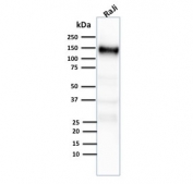 Western blot testing of human Raji cell lysate with CD21 antibody (clone CR2/2754).