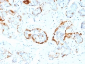IHC staining of FFPE human breast tissue with CRYAB antibody (clone CPTC-CRYAB-1). HIER: boil tissue sections in pH6, 10mM citrate buffer, for 10-20 min and allow to cool before testing.